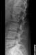 L�ndrygg sida